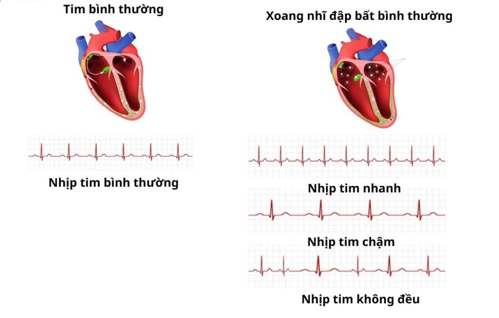 Các dạng bệnh tim mạch thường gặp cần lưu ý